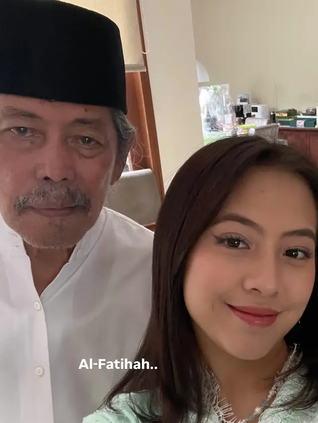 Adhisty Zara dan Acil Bimbo