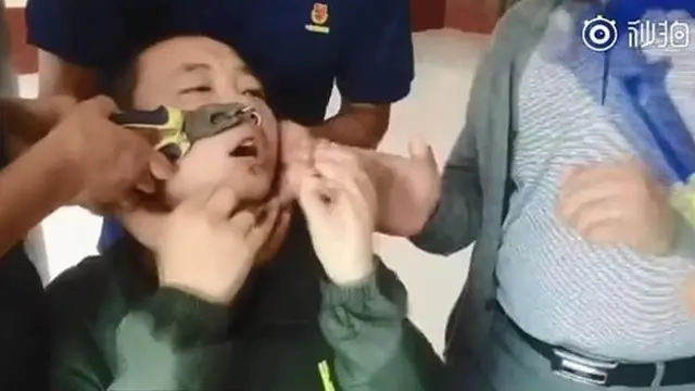 Iseng Bermain Gantungan Kunci di Hidung, Bocah Ini Akhirnya Menyesal