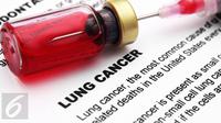 Ilustrasi Kanker Paru Paru (iStockphoto)