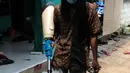 Ronald Regen (33), perajin yang juga penyandang disabilitas membawa kaki palsu di Dusun IV Rawailat, Desa Dayeuh, Cileungsi, Bogor, Jawa Barat, Selasa (29/3/2022). UMKM kaki palsu yang sempat bangkrut akibat pandemi COVID-19 mulai bangkit sejak awal tahun. (merdeka.com/Arie Basuki)