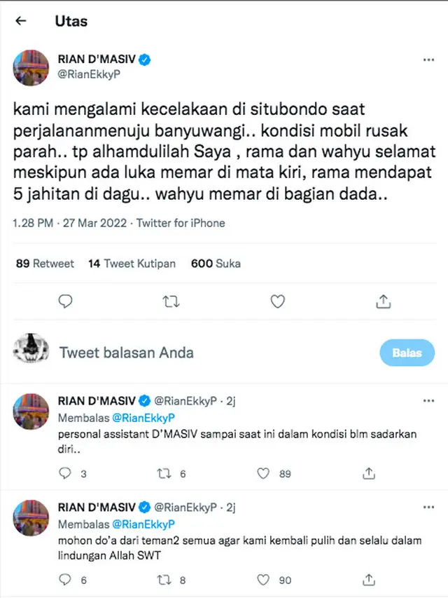 Kondisi Personel D'Masiv Usai Alami Kecelakaan Parah, dari Memar Hingga Mendapat Jahitan di Wajah