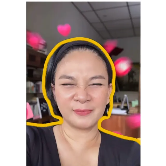 6 Potret Dian Nitami Pasca 3 Minggu Oplas Face Lifting, Kerutan Wajah Berkurang