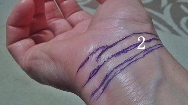 Ketahui Peruntunganmu Berdasarkan Garis Pergelangan Tangan