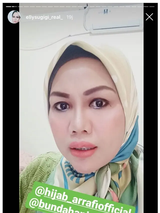 6 Potret Terbaru Elly Sugigi saat Pakai Behel, Makin Cantik