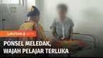 Seorang pelajar menderita luka bakar di wajah dan matanya tidak dapat melihat dengan jelas, setelah terkena ledakan ponsel di sekolah. Saat itu korban hendak menyalakan ponsel usai diisi baterai.