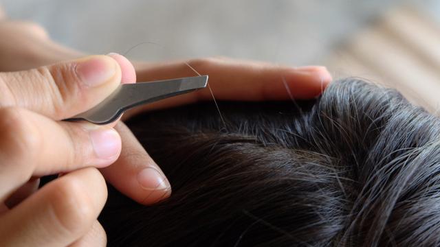 Rambut Menipis pada Pria, Apa Sih Penyebabnya? Waspadai Risiko Kebotakan, Temukan Solusinya!