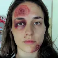 Akhir mengerikan harus dihadapi perempuan ini, terlihat dari 'selfie' yang dilakukannya setiap hari selama 1 tahun.