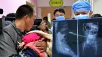 Misteri 12 Jarum di Dalam Tubuh Bayi 11 Bulan