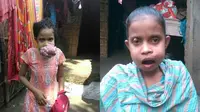 Setelah beberapa tahun menderita, gadis cilik ini akhirnya bisa makan, berbicara secara normal lagi.