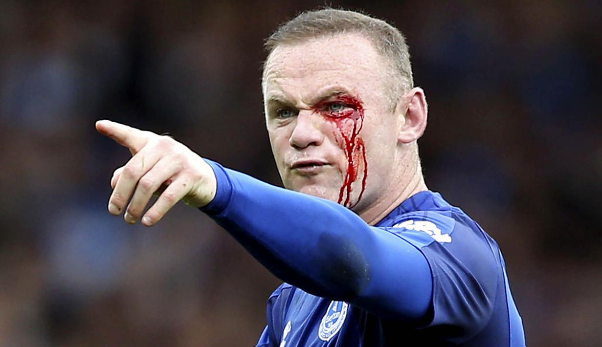 Striker Everton, Wayne Rooney, mengalami pendarahan di mata kirinya usai duel udara dengan bek Bournemouth, Simon Francis, pada Premier League, di Stadion Goodison Park, Sabtu (23/9/2017). Everton menang 2-1 atas Bournemouth. (AP/Barrington Coombs)