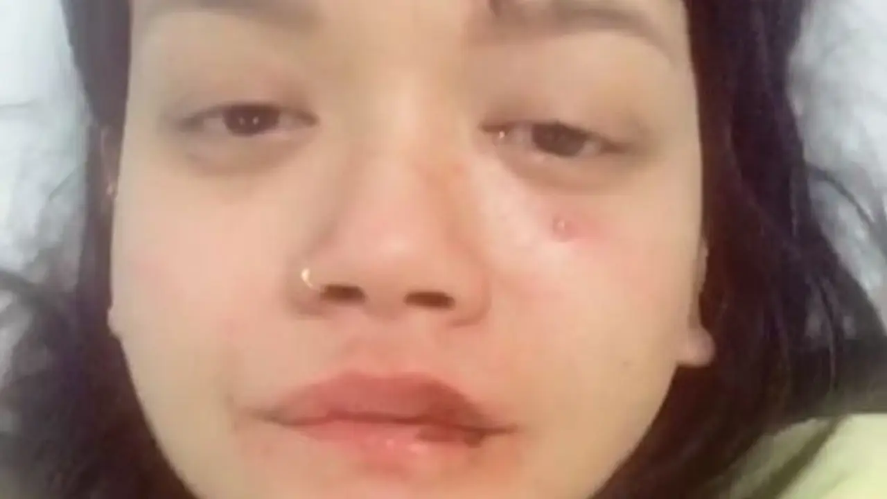 [Bintang] Dylan Sada, Model Cantik Asal Indonesia yang Merintis Karier di New York Alami Kekerasan
