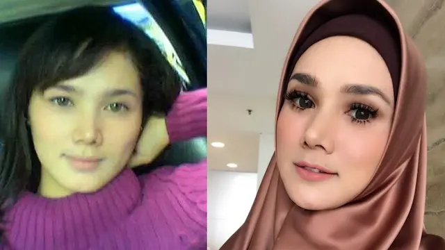 Penampilan Berbeda Drastis, 5 Seleb ini Dituding Operasi Plastik