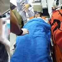 Hal mengerikan terjadi pada mata perempuan ini saat dirinya memakai eyeliner di dalam mobil. Jangan sampai kamu juga megalaminya. (Sumber Foto: Oddity Central)