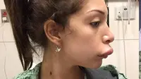 Mantan bintang remaja Farrah Abraham (23) belum lama ini memposting foto bibirnya yang membengkak