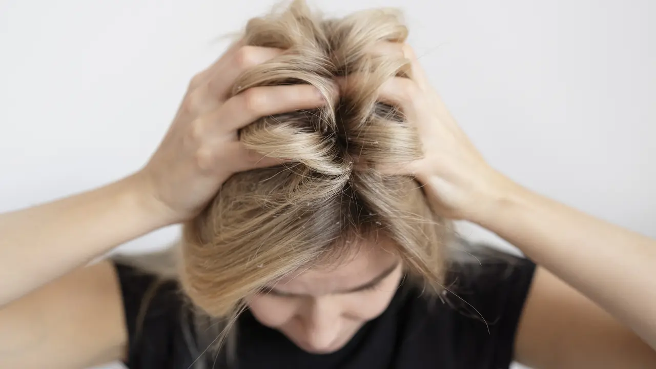 Rambut Berketombe