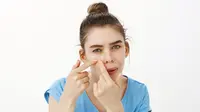 How to Get Rid of Blackheads and How to Prevent It