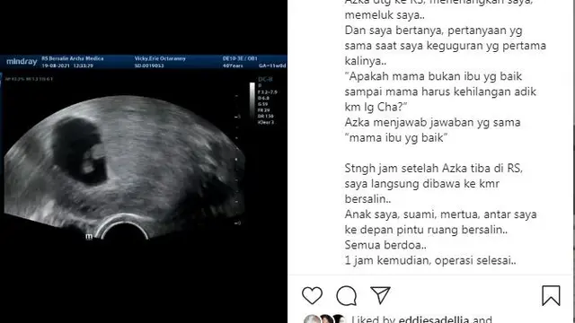 Cerita Kalina Ocktaranny yang disemangati Azka Corbuzier Saat Alami keguguran