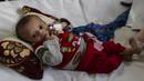 Seorang bayi laki-laki terbaring di tempat tidur saat menjalani perawatan di bangsal gizi buruk RS Anak Nasional Ataturk, Kabul, Afghanistan, 2 Desember 2021. Menurut PBB dari awal November, 8,7 juta orang di Afghanistan hidup mendekati kelaparan. (AP Photo/Petros Giannakouris)