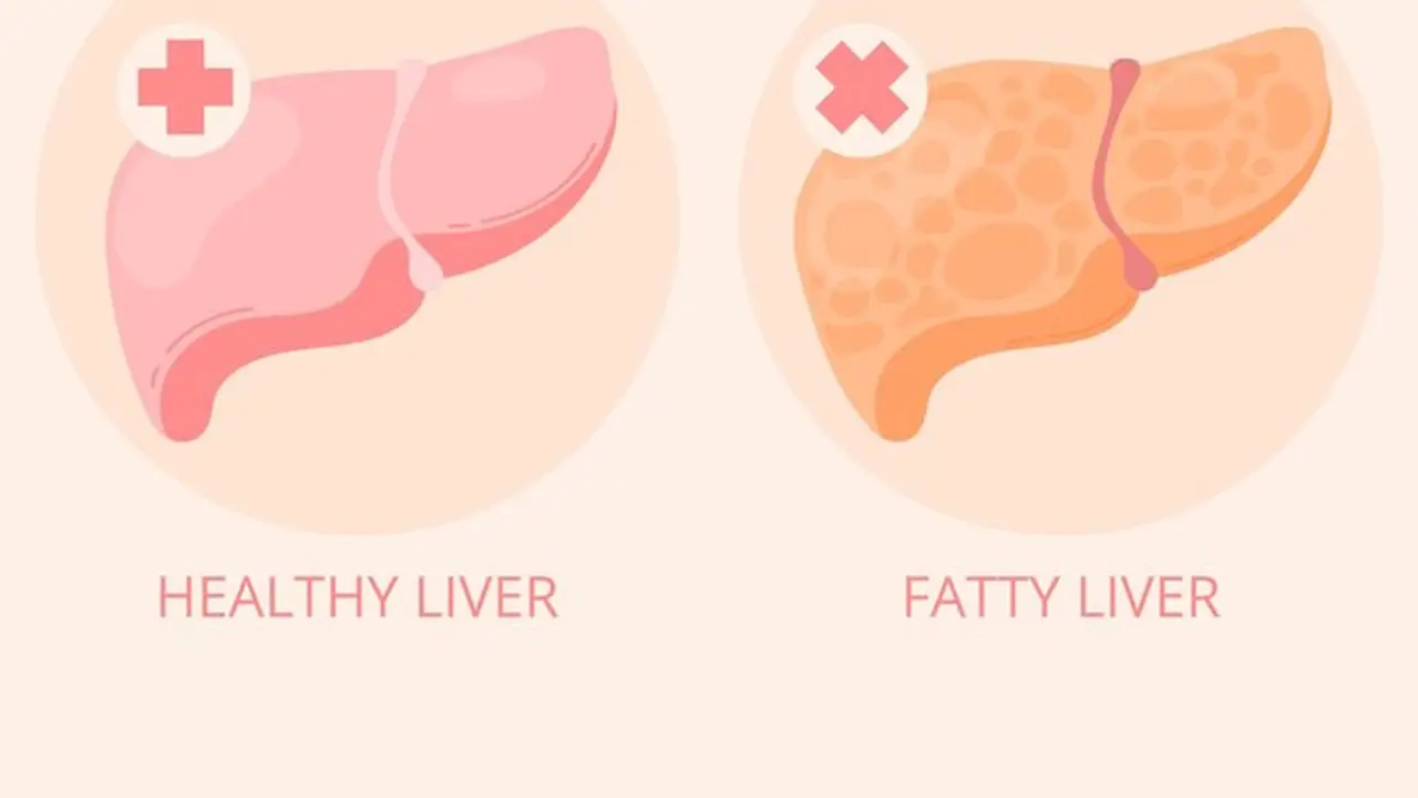 Ilustrasi organ hati