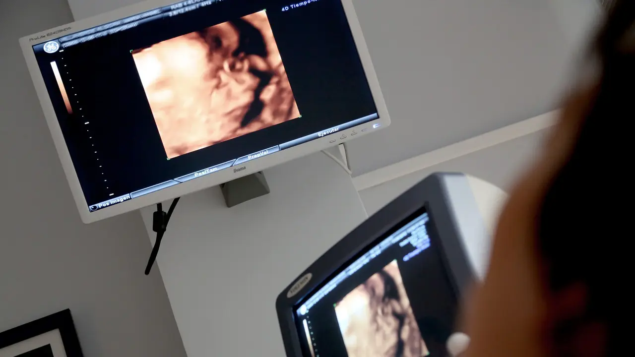 Kemenkes Koordinasi dengan KKI untuk Nonaktifkan Sementara STR Oknum Dokter Obgyn Garut yang Diduga Lecehkan Pasien