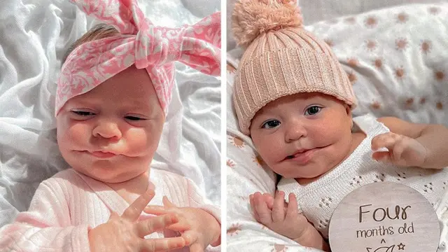 Alami Kondisi Sangat Langka, Bayi Ini Lahir dengan Mulut Selau Tersenyum