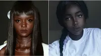 Kulit Sehitam Arang, 5 Model Ini Buktikan Cantik Tak Harus Putih