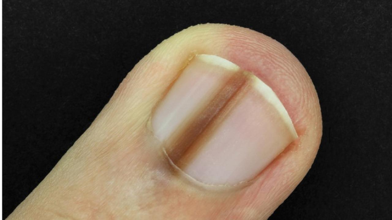 Masalah Kesehatan, 7 Perubahan pada Tubuh Anda Ini Harus Diperhatikan