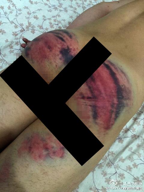 Luka parah akibat pukulan polisi | Photo: Copyright shanghaiist.com