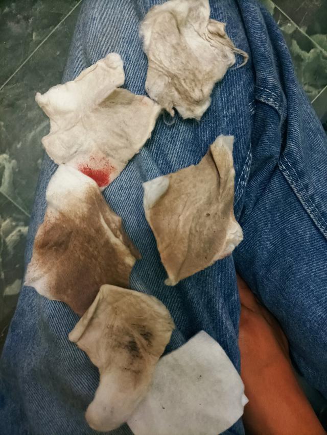 6 Potret Wajah Kotor karena Polusi Udara Ini Bikin Elus Dada