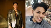 6 Potret Terbaru Ivan Gunawan Usai Turun 47 Kg, Segera Operasi Payudara