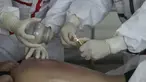 Seorang pasien yang terinfeksi virus corona COVID-19 menerima perawatan dengan teknik medis tradisional Tiongkok yang dikenal sebagai "bekam" di Rumah Sakit Palang Merah di Wuhan di provinsi Hubei China (11/3/2020). China melaporkan peningkatan kasus virus corona pada Maret 11. (AFP/STR)
