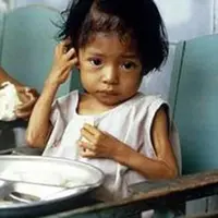 Gizi buruk rawan terjadi ada anak umur 1-3 tahun. Hindari dan kenali tanda-tandanya!