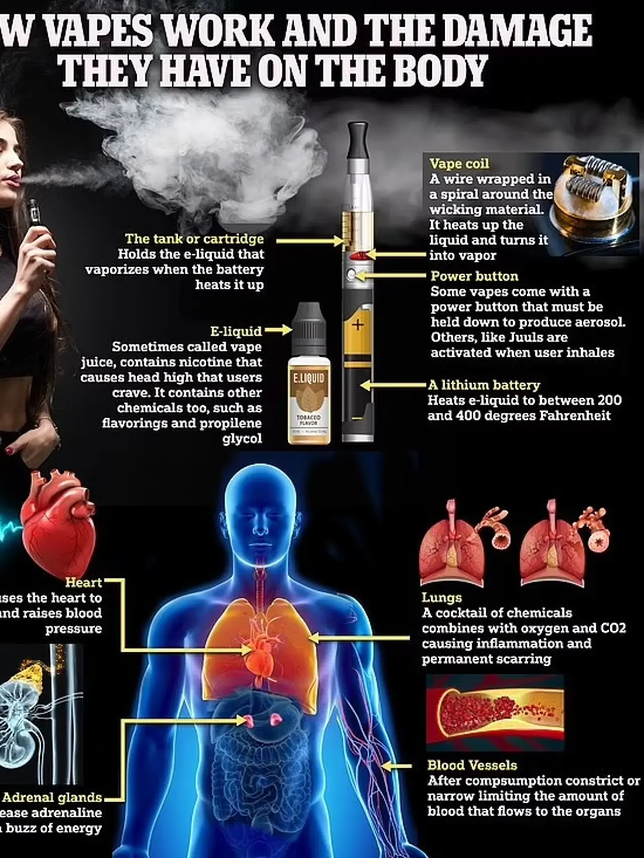 Kisah Tragis Gadis 12 Tahun Koma karena Vape, Kehilangan Satu Paru-Paru ...