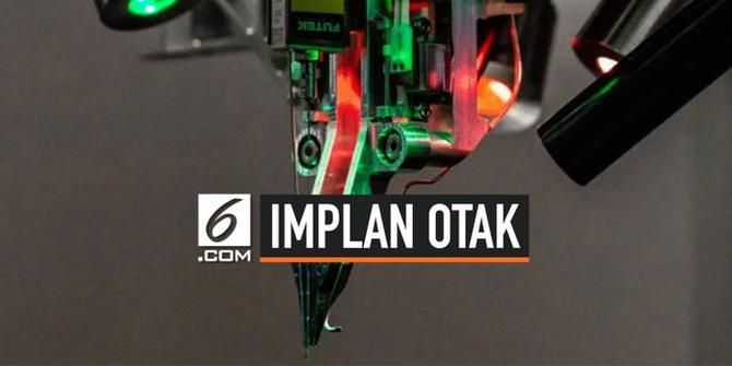 VIDEO: Jadi Kenyataan, Otak Manusia Bisa Terhubung ke Komputer