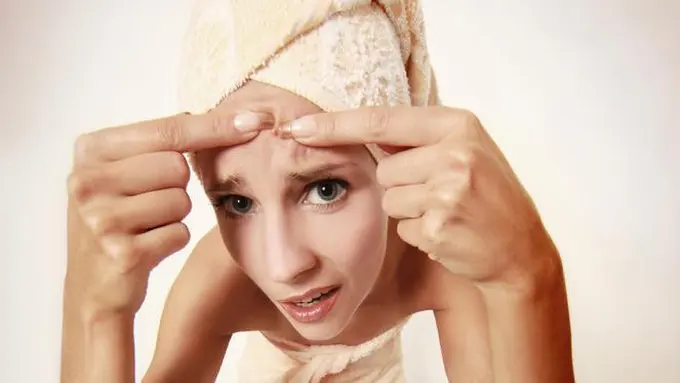 Tips Mengobati Jerawat di Dahi yang Mengganggu