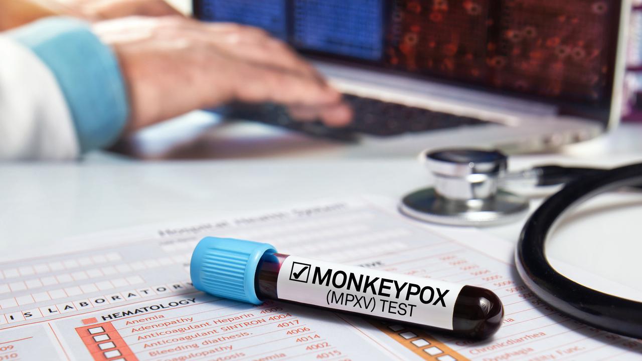 Ramai Monkeypox atau Mpox, Seperti Apa Penyebab, Gejala dan Cara Penanganannya?