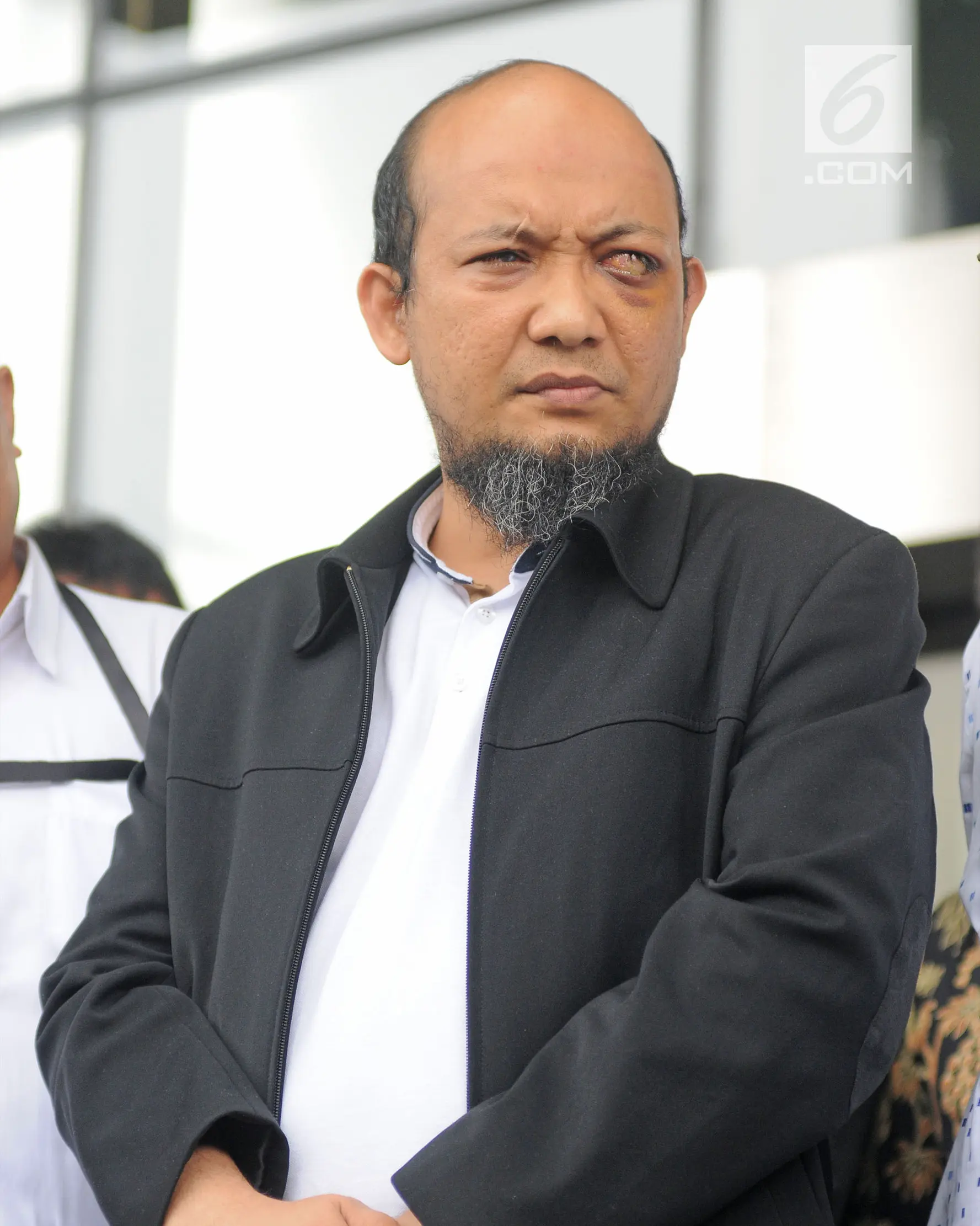 Penyidik senior KPK Novel Baswedan saat berada di gedung KPK, Jakarta, Kamis (22/2). Sebelumnya Novel Baswedan disiram air keras saat pulang salat berjamaah pada subuh 11 April 2017. (Liputan6.com/Herman Zakharia)