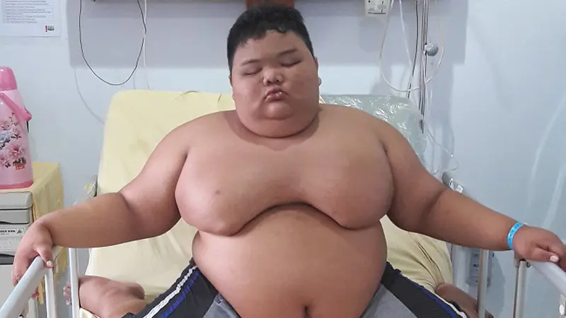 Ibu Rizki Bocah Obesitas Palembang: Anak Saya Koma