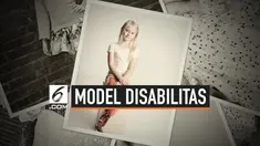Daisy May Demetre, model cilik yang juga penyandang disabilitas dari Birmingham, Inggris. Di usianya yang ke-7 tahun, Daisy berhasil menjadi model cilik profesional di bawah naungan agen modeling besar.