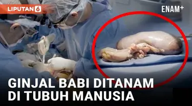 Tak ada yang menyangka jiga organ ginjal babi ternyata bisa ditranplantasi ke tubuh manusia dan berfungsi selama dua bulan. Eksperimen dramatis telah dilakukan tim dokter di Amerika Serikat yang munculkan harapan ginjal babi bisa digunakan di masa de...