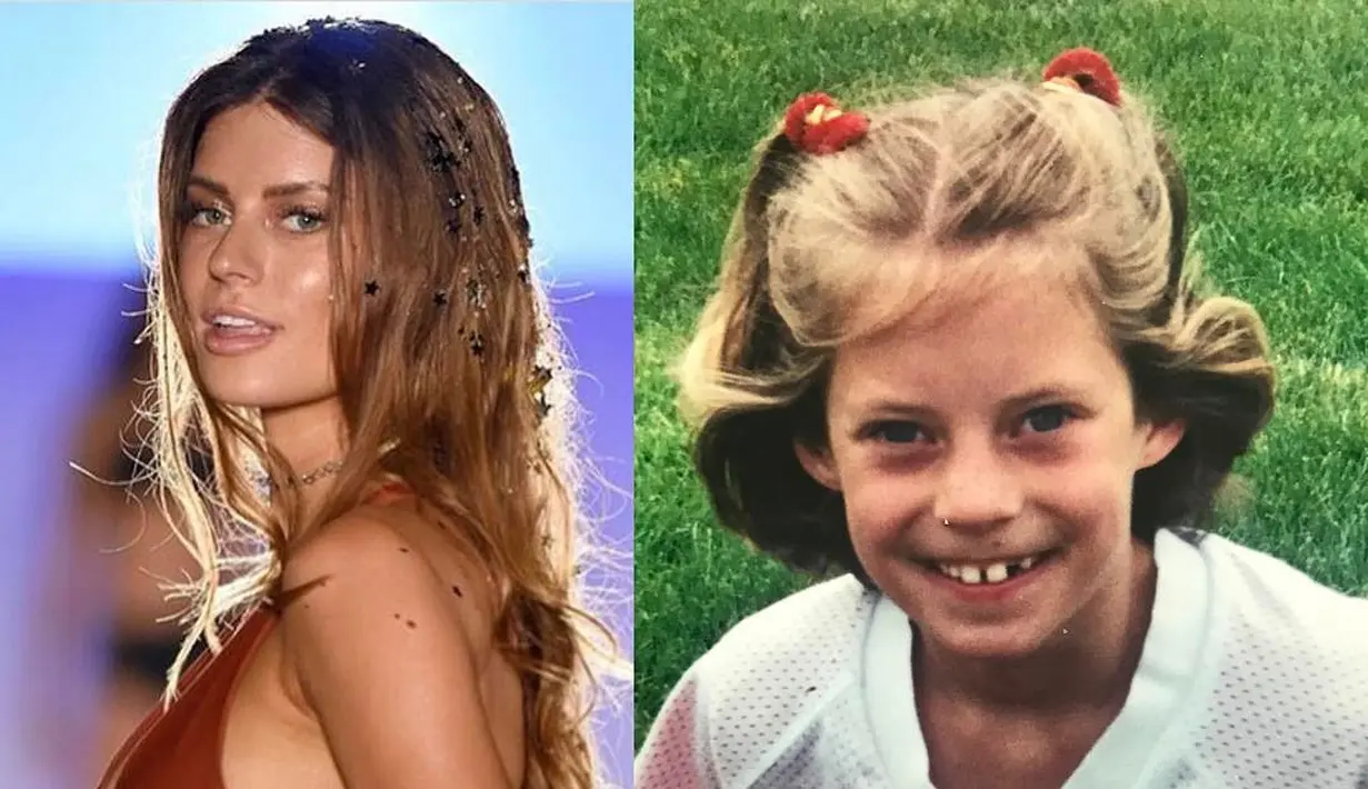 Hannah sendiri memang patut diakui miliki waja h yang cantik. Namun ternyata, dulunya ia pun sempat terihat cupu, lho!(instagram/hannahstockings)