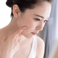 Ilustrasi tips seputar jerawat/copyright shutterstock