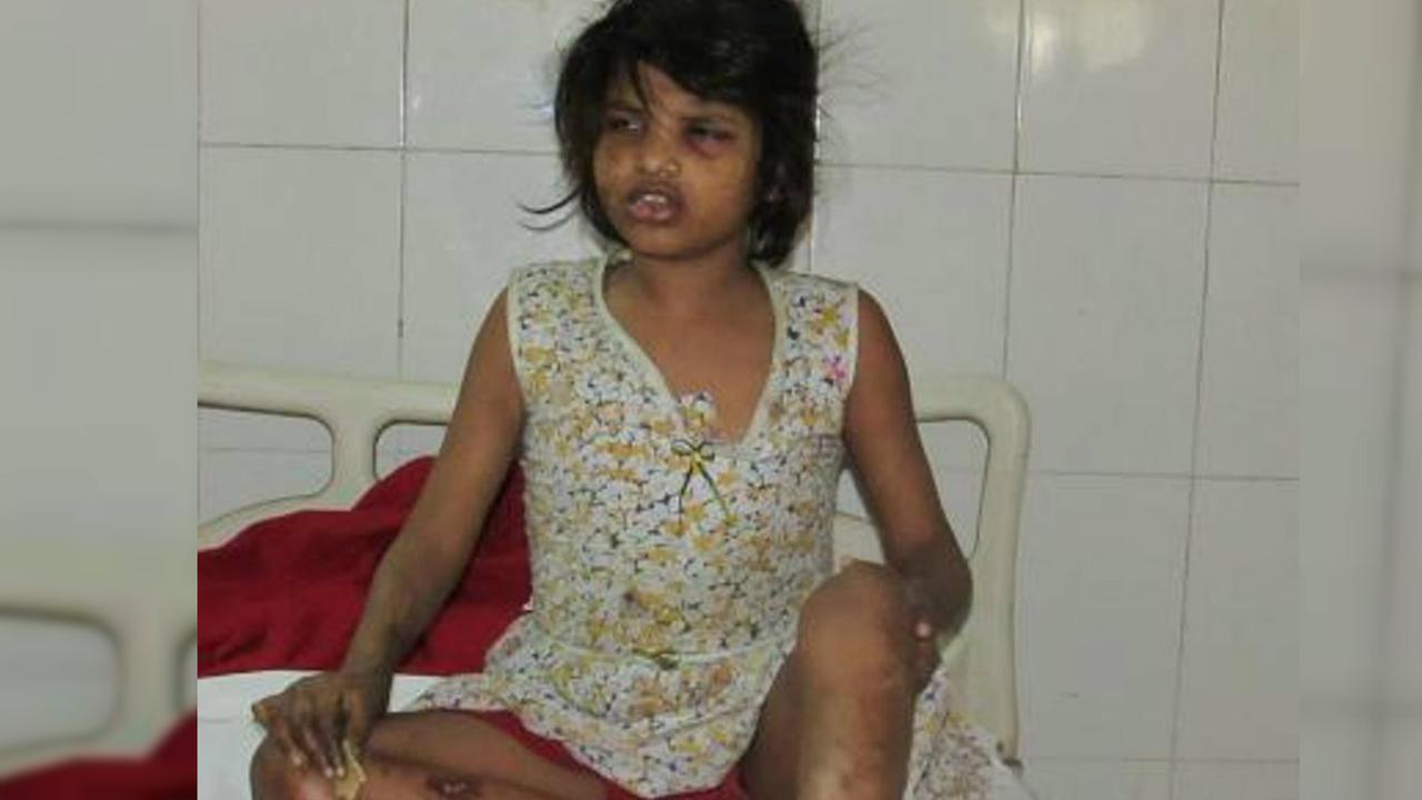 Bocah Mowgli dari India. (Times of India)