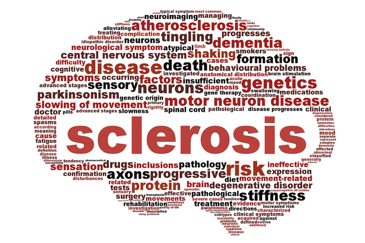 Mengenal Multiple Sclerosis, Penyakit Pepeng Jari-jari