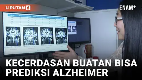 VIDEO: Inovasi Kecerdasan Buatan Mampu Prediksi Alzheimer