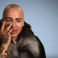 Nggak paham lagi deh sama Jordan Parke. Dia ingin banget bibirnya kayak Kim Kardashian.