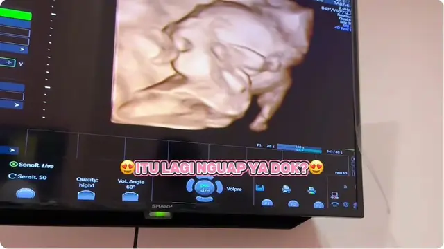 6 Potret Kakak Ria Ricis Periksa Kandungan Ditemani Suami, Bayi Aktif saat di USG
