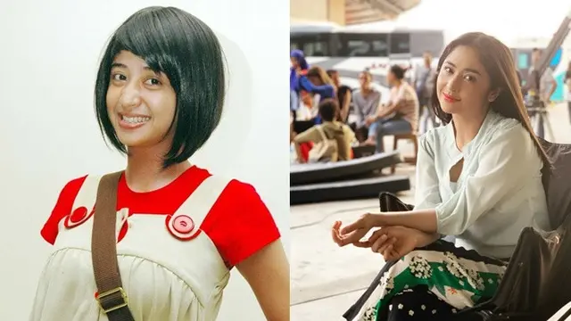 7 Potret Lawas Pedangdut Cantik Sebelum dan Sesudah Terkenal Ini Bikin Pangling