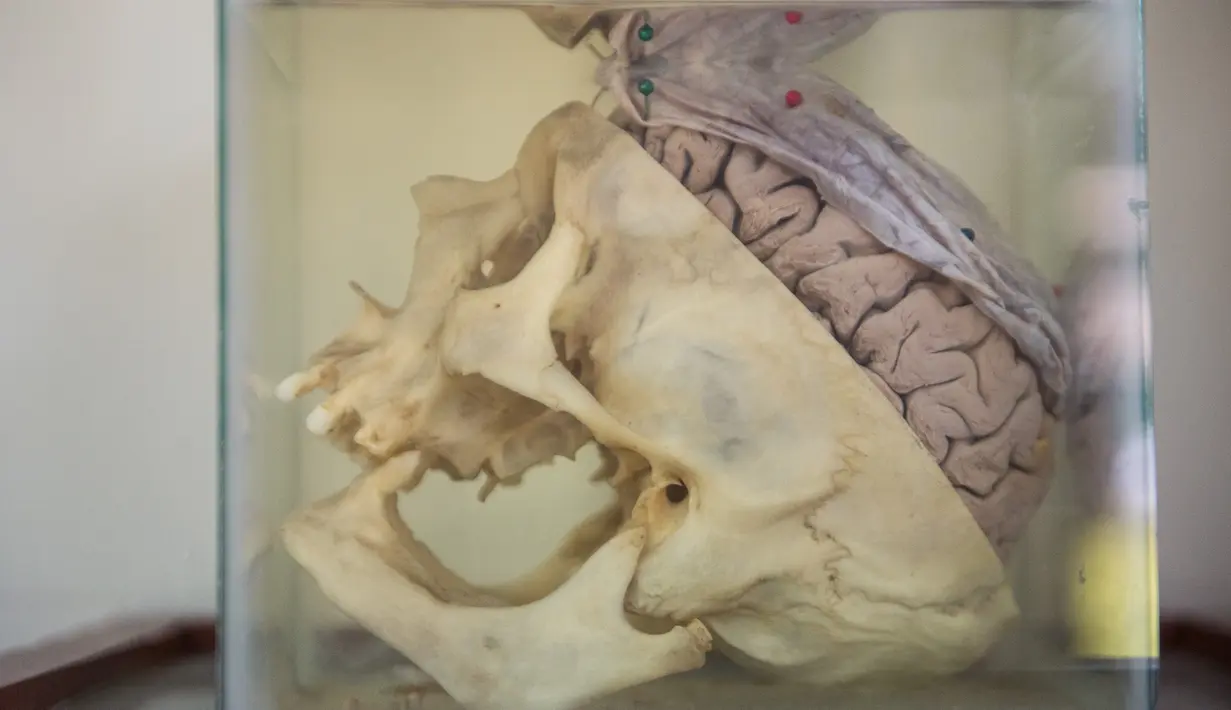 Salah satu otak manusia yang diawetkan di Museum Neuropatologi, di Rumah Sakit Santo Toribio de Mogrovejo, Lima, Peru (16/11). Neuroptologi adalah adalah sebuah subspesialisasi patologi yang berhubungan dengan penyakit otak. (AFP Photo/Ernesto Benavides)