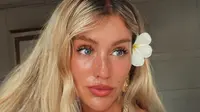 Turis asing yang merupakan beauty influencer bernama Charlene Morrissey dilaporkan kecelakaan di Bali. (dok. Instagram @___itsher/https://www.instagram.com/p/C5K3yYGLbS1/)